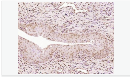 6052b26ce5a88.png image.png