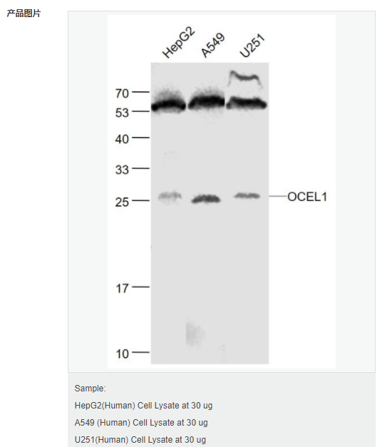 60541685be0be.png image.png