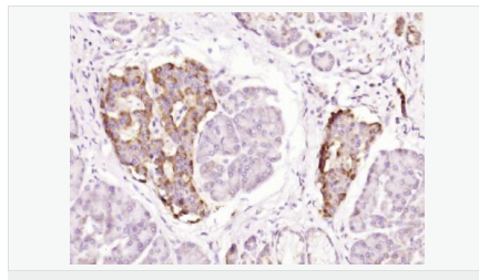 605432e85f89b.png image.png