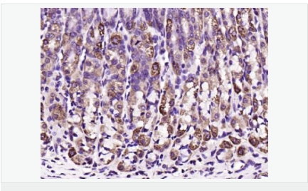 605447093edf3.png image.png