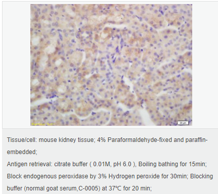 6054470f5ba98.png image.png