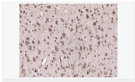 6057ee103eda8.png image.png