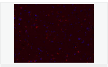 60585130ce4f1.png image.png