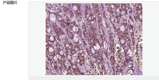 6058539032a47.png image.png