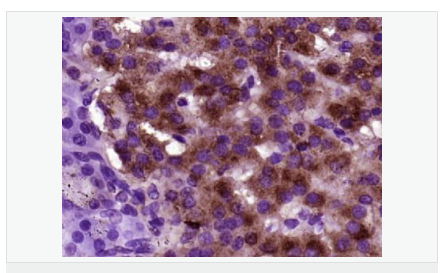 6059407fba8d6.png image.png