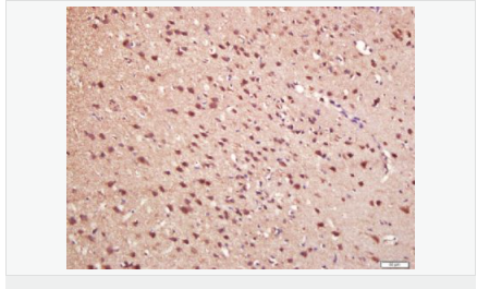 60594299e6bf5.png image.png