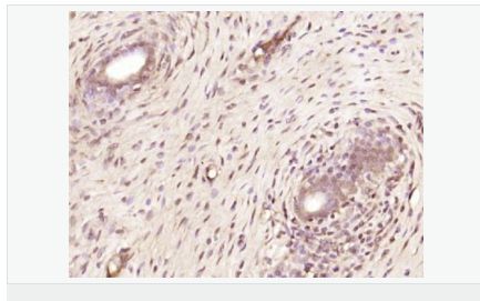 60599af2bdddf.png image.png