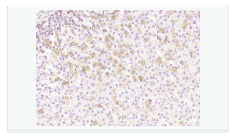 605ab12687ede.png image.png