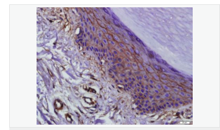 605d764a0a118.png image.png