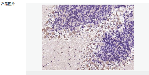 6063d4dd7f81f.png image.png