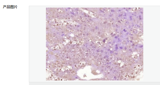 607651dba5f07.png image.png