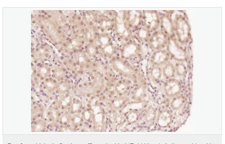 6076570279b93.png image.png