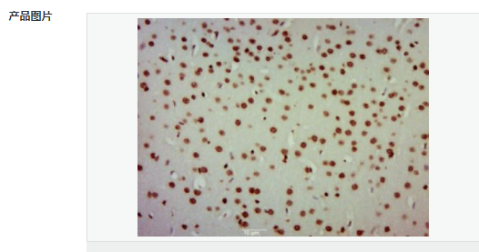 6076574108a68.png image.png